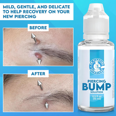 Piercing Bump Solution for Keloid and Bump Care